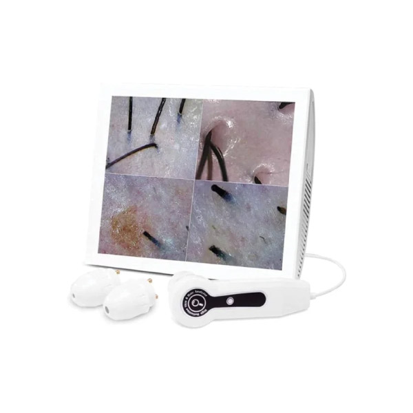 Lizze-15-inch-scalp-and-hair-analyzer دستگاه آنالیز پوست سر و مو 15 اینچ Lizze - Image 1